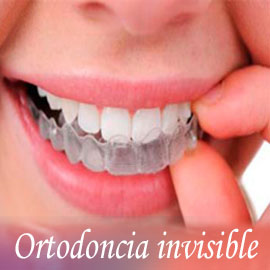 Ortodoncia invisible